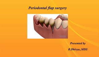 Periodontal flap surgery
Presented by
R.Dhivya.,MDS
 