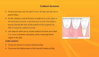 Cutback Incisions
 Vertical incisions may be used to move the flap laterally (as in
pedicle flap.)
 In this situation vertical incision is made at an acute angle to
the horizontal incision, in the direction toward which flap is
moved, placing the base of the pedicle at the recipient site.
This is termed as cutback incision.
 care must be taken not to extend cutback incisions more than
2 to 3 mm to minimize disruption of the remaining blood
supply to the flap.
INDICATIONS
 To prevent tension in tissues during healing
 To prevent the displacement of the laterally displaced flap
32
 