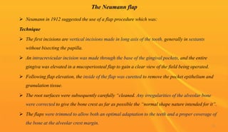The Neumann flap
 Neumann in 1912 suggested the use of a flap procedure which was:
Technique
 The first incisions are vertical incisions made in long axis of the tooth, generally in sextants
without bisecting the papilla.
 An intracrevicular incision was made through the base of the gingival pockets, and the entire
gingiva was elevated in a mucoperiosteal flap to gain a clear view of the field being operated.
 Following flap elevation, the inside of the flap was curetted to remove the pocket epithelium and
granulation tissue.
 The root surfaces were subsequently carefully “cleaned. Any irregularities of the alveolar bone
were corrected to give the bone crest as far as possible the “normal shape nature intended for it”.
 The flaps were trimmed to allow both an optimal adaptation to the teeth and a proper coverage of
the bone at the alveolar crest margin. 51
 