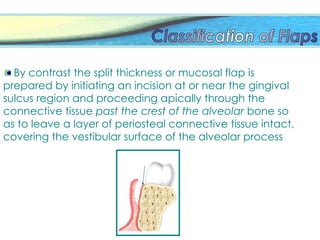 By contrast the split thickness or mucosal flap is
prepared by initiating an incision at or near the gingival
sulcus region and proceeding apically through the
connective tissue past the crest of the alveolar bone so
as to leave a layer of periosteal connective tissue intact,
covering the vestibular surface of the alveolar process
 