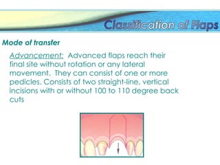 Mode of transfer
Advancement: Advanced flaps reach their
final site without rotation or any lateral
movement. They can consist of one or more
pedicles. Consists of two straight-line, vertical
incisions with or without 100 to 110 degree back
cuts
 