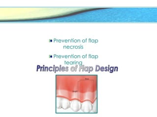Prevention of flap
necrosis
Prevention of flap
tearing
 