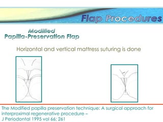 The Modified papilla preservation technique: A surgical approach for
interproximal regenerative procedure –
J Periodontal 1995 vol 66; 261
Horizontal and vertical mattress suturing is done
 