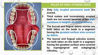 Periodontal indices final | PPTX