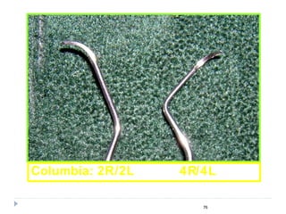 76
Columbia: 2R/2L 4R/4L
 