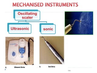 113
Oscillating
scaler
Ultrasonic sonic
 