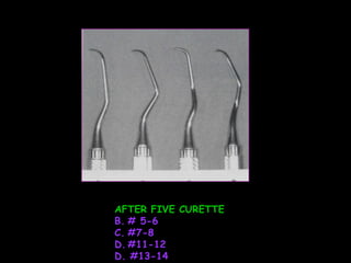 AFTER FIVE CURETTE # 5-6  #7-8 #11-12 D. #13-14 
