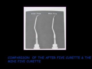 COMPARISON  OF THE AFTER FIVE CURETTE & THE MINI FIVE CURETTE 
