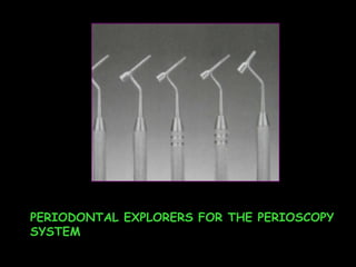 PERIODONTAL EXPLORERS FOR THE PERIOSCOPY SYSTEM 