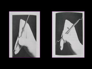 MODIFIED PEN GRASP STANDARD PEN GRASP 