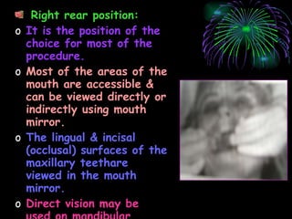 Right rear position: It is the position of the choice for most of the procedure. Most of the areas of the mouth are accessible & can be viewed directly or indirectly using mouth mirror. The lingual & incisal (occlusal) surfaces of the maxillary teethare viewed in the mouth mirror. Direct vision may be used on mandibular teeth, particularly on the left side. 