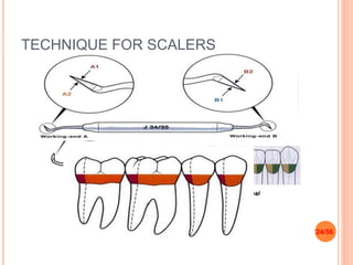 Srp Instruments Periodontal instruments | PPTX