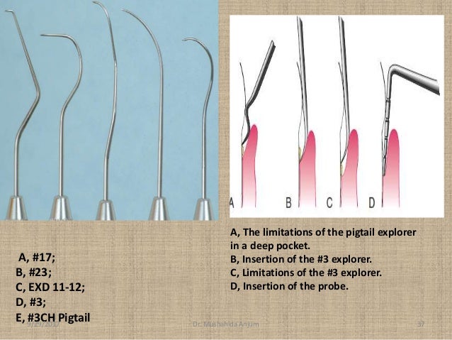 Periodontal Instruments Periodontal Instruments