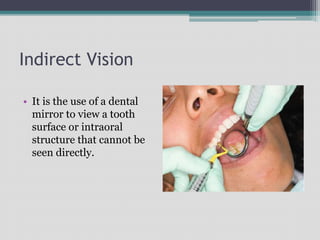 Indirect Vision
• It is the use of a dental
mirror to view a tooth
surface or intraoral
structure that cannot be
seen directly.
 