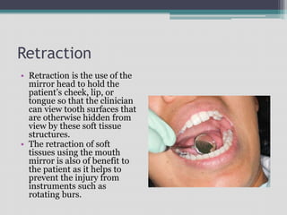 Retraction
• Retraction is the use of the
mirror head to hold the
patient’s cheek, lip, or
tongue so that the clinician
can view tooth surfaces that
are otherwise hidden from
view by these soft tissue
structures.
• The retraction of soft
tissues using the mouth
mirror is also of benefit to
the patient as it helps to
prevent the injury from
instruments such as
rotating burs.
 