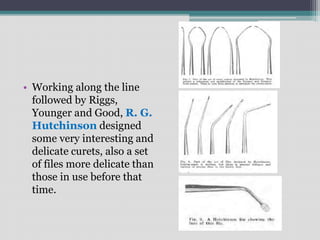 • Working along the line
followed by Riggs,
Younger and Good, R. G.
Hutchinson designed
some very interesting and
delicate curets, also a set
of files more delicate than
those in use before that
time.
 