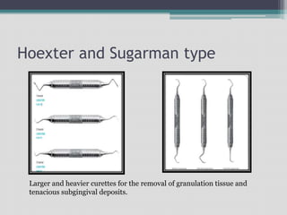 Hoexter and Sugarman type
Larger and heavier curettes for the removal of granulation tissue and
tenacious subgingival deposits.
 