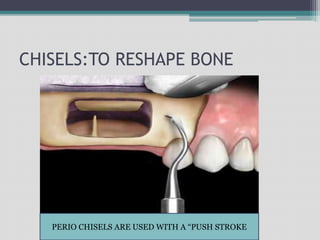 CHISELS:TO RESHAPE BONE
PERIO CHISELS ARE USED WITH A “PUSH STROKE
 