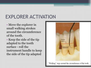 EXPLORER ACTIVATION
• Move the explorer in
small walking strokes
around the circumference
of the tooth.
• Keep the side of the tip
adapted to the tooth
surface - roll the
instrument handle to keep
the side of the tip adapted
 