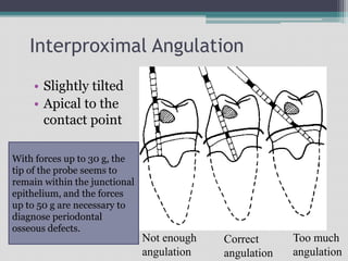 Interproximal Angulation
• Slightly tilted
• Apical to the
contact point
Not enough
angulation
Correct
angulation
Too much
angulation
With forces up to 30 g, the
tip of the probe seems to
remain within the junctional
epithelium, and the forces
up to 50 g are necessary to
diagnose periodontal
osseous defects.
 