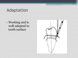 Adaptation
• Working end is
well-adapted to
tooth surface
 