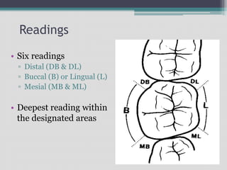 Readings
• Six readings
▫ Distal (DB & DL)
▫ Buccal (B) or Lingual (L)
▫ Mesial (MB & ML)
• Deepest reading within
the designated areas
 