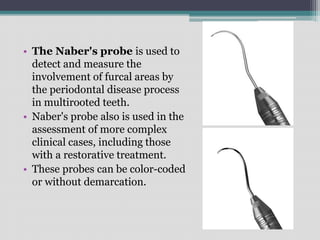 • The Naber's probe is used to
detect and measure the
involvement of furcal areas by
the periodontal disease process
in multirooted teeth.
• Naber's probe also is used in the
assessment of more complex
clinical cases, including those
with a restorative treatment.
• These probes can be color-coded
or without demarcation.
 