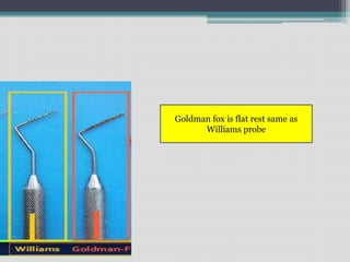 Goldman fox is flat rest same as
Williams probe
 