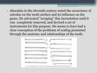 • Abucalsis in the eleventh century noted the occurrence of
calculus on the tooth surface and its influence on the
gums. He advocated "scraping” this incrustation until it
was completely removed, and devised a set of
instruments for this purpose. He seems to have had a
clear conception of the problems of scaling presented
through the anatomy and relationships of the teeth.
 