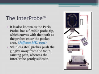 The InterProbe™
• It is also known as the Perio
Probe, has a flexible probe tip,
which curves with the tooth as
the probes enter the pocket
area. (Jeffcoat MK. 1991)
• Stainless steel probes push the
gingiva away from the tooth,
causing pain, whereas the
InterProbe gently slides in.
 