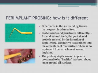PERIIMPLANT PROBING: how is it different
• Differences in the surrounding tissues
that support implanted teeth.
• Probe inserts and penetrates differently. -
Around natural teeth, the periodontal
probe is resisted by the insertion of
supra-crestal connective tissue fibers into
the cementum of root surface. There is no
equivalent fiber attachment around
implants.
• The probing depth around implants
presumed to be “healthy” has been about
3mm around all surfaces.
 