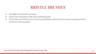 ● Available in wheel and cup shapes
● Used in the prophylaxis angle with a polishing paste
● The bristles are stiff, thus use of the brush should be conﬁned to the crown to avoid injuring the
cementum and the gingiva.
112
Carranza FA. Clinical Periodontology. Philadelphia: W. B. Saunders Company, 1989.
BRISTLE BRUSHES
 