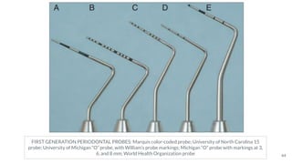 44
FIRST GENERATION PERIODONTAL PROBES: Marquis color-coded probe; University of North Carolina 15
probe; University of Michigan “O” probe, with William’s probe markings; Michigan “O” probe with markings at 3,
6, and 8 mm; World Health Organization probe
 