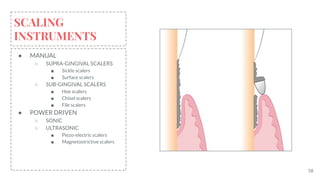 58
SCALING
INSTRUMENTS
● MANUAL
○ SUPRA-GINGIVAL SCALERS
■ Sickle scalers
■ Surface scalers
○ SUB-GINGIVAL SCALERS
■ Hoe scalers
■ Chisel scalers
■ File scalers
● POWER DRIVEN
○ SONIC
○ ULTRASONIC
■ Piezo-electric scalers
■ Magnetostrictive scalers
 