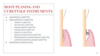 73
ROOT PLANING AND
CURETTAGE INSTRUMENTS
● UNIVERSAL CURETTES
● AREA SPECIFIC CURETTES
○ GRACEY CURETTES
○ AFTER FIVE CURETTES
○ MINI-BLADED CURETTES
○ MICRO-MINI CURETTES
○ GRACEY CURVETTES
○ QUETIN FURCATION CURETTES
○ PERIODONTAL MAINTENANCE CURETTES
○ LANGER AND MINI LANGER CURETTES
● DIAMOND-COATED FILES
 