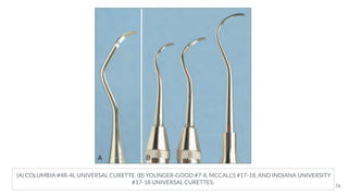 (A) COLUMBIA #4R-4L UNIVERSAL CURETTE. (B) YOUNGER-GOOD #7-8, MCCALL’S #17-18, AND INDIANA UNIVERSITY
#17-18 UNIVERSAL CURETTES.
76
 