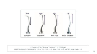 COMPARISON OF GRACEY CURETTE DESIGNS.
LEFT TO RIGHT, STANDARD #1-2, AFTER FIVE #1-2, MINI FIVE #1-2, MICRO MINI FIVE #1-2.
88
 