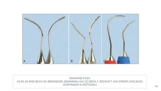 DIAMOND FILES.
(A) #1, #2 AND (B) #3, #4. (BRASSELER, SAVANNAH, GA.) (C) SDCN 7, SDCM/D 7. (HU-FRIEDY, CHICAGO.)
(COPYRIGHT A. PATTISON.)
98
 