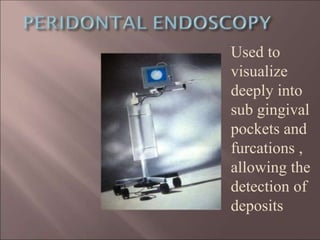 Used to
visualize
deeply into
sub gingival
pockets and
furcations ,
allowing the
detection of
deposits
 