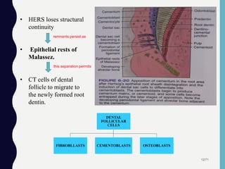 12/71
• HERS loses structural
continuity
• Epithelial rests of
Malassez.
• CT cells of dental
follicle to migrate to
the newly formed root
dentin.
DENTAL
FOLLICULAR
CELLS
FIBROBLLASTS CEMENTOBLASTS OSTEOBLASTS
remnants persist as
this separation permits
 