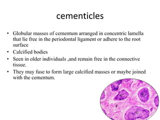 cementicles
• Globular masses of cementum arranged in concentric lamella
that lie free in the periodontal ligament or adhere to the root
surface
• Calcified bodies
• Seen in older individuals ,and remain free in the connective
tissue.
• They may fuse to form large calcified masses or maybe joined
with the cementum.
66
 