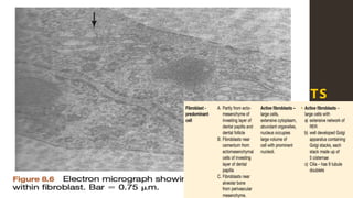 Most
predominant
cell type of
periodontal
ligament.
Found between
the fibers of
the periodontal
ligament,
where they are
surrounded by
fibers and
ground
substance.
STRUCTURE:
Ovoid or
elongated cells
oriented along
the principal
fibres.
Large cells with
an extensive
cytoplasm
Associated with
protein
synthesis &
secretion (e.g.
RER, several
Golgi complex,
& many
secretary
vesicles)
FIBROBLASTS
 