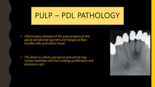 Pulp Bundle Periodontal ligament - Part 2 | PPTX