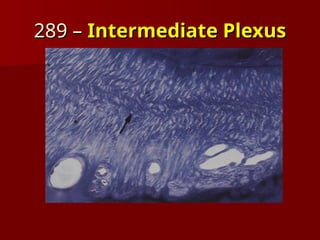 Plexus Intrinseque Periodontal Ligament & Development presentation | PPT