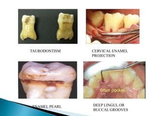 Periodontal ligament in disease | PPTX