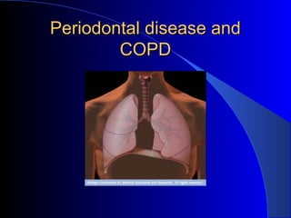 Periodontal disease and
COPD

 