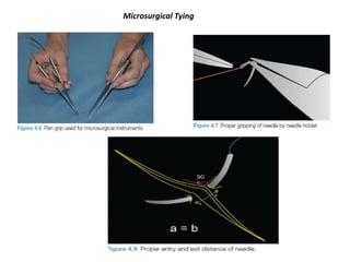 Microsurgical Tying
 