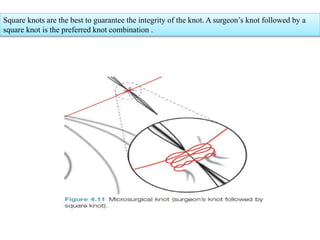 Square knots are the best to guarantee the integrity of the knot. A surgeon’s knot followed by a
square knot is the preferred knot combination .
 