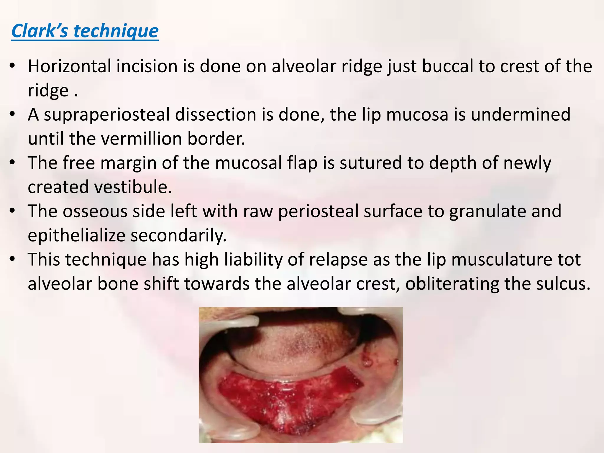 Periodontal plastic and esthetic surgery | PPTX