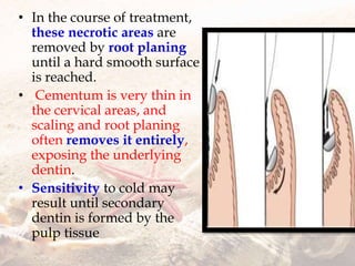 • In the course of treatment,
these necrotic areas are
removed by root planing
until a hard smooth surface
is reached.
• Cementum is very thin in
the cervical areas, and
scaling and root planing
often removes it entirely,
exposing the underlying
dentin.
• Sensitivity to cold may
result until secondary
dentin is formed by the
pulp tissue
 